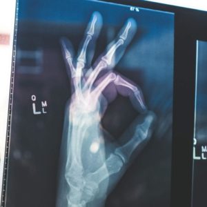 Ok Hand XRay